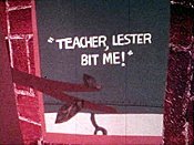 Teacher, Lester Bit Me! Picture Of Cartoon